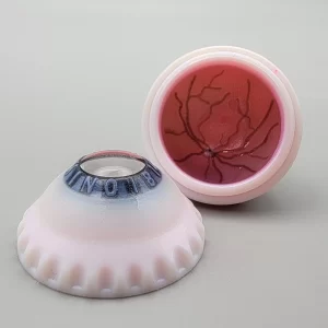 XCHANGE Complete – Subretinal Injection