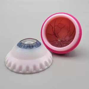 XCHANGE Complete – Vitrectomy & PVD